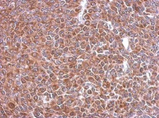 STI1 Antibody