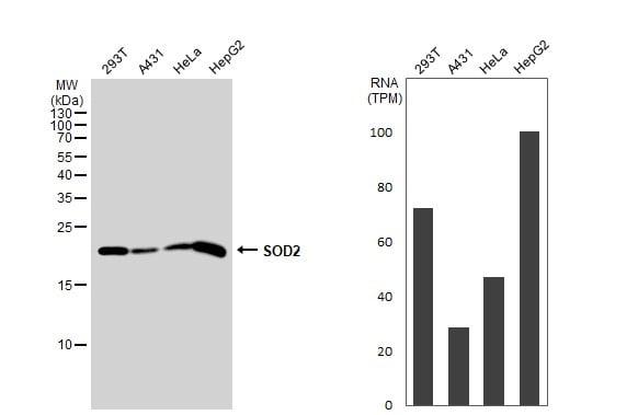 SOD2/Mn-SOD Antibody