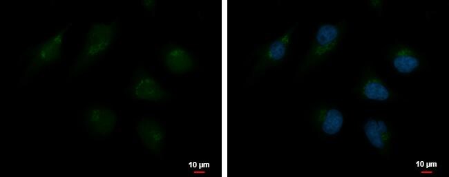TATA Element Modulatory Factor 1 Antibody