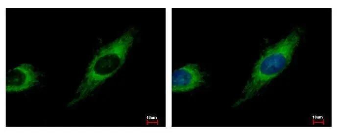 TBRG4 Antibody - BSA Free