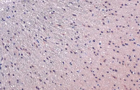 TCF-3/E2A Antibody