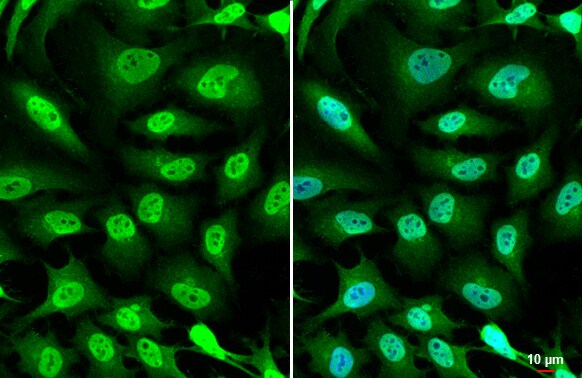 TCF-3/E2A Antibody