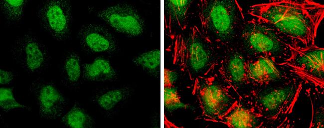 TET3 Antibody