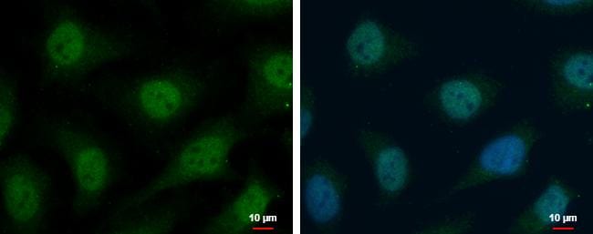 Thioredoxin Reductase 1/TRXR1 Antibody