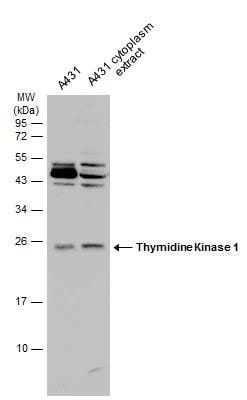 Thymidine Kinase 1 Antibody - BSA Free