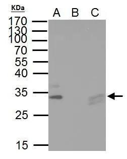 TIP30 Antibody