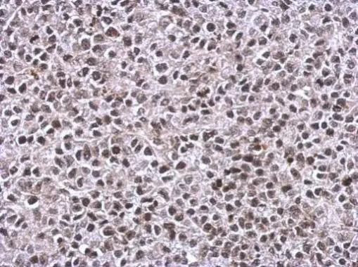 TIP60 Antibody - BSA Free