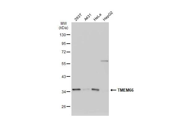 TMEM66 Antibody