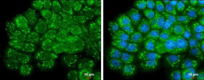 Airway Trypsin-like Protease/HAT/TMPRSS11D Antibody - BSA Free