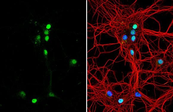Tenascin R Antibody - BSA Free