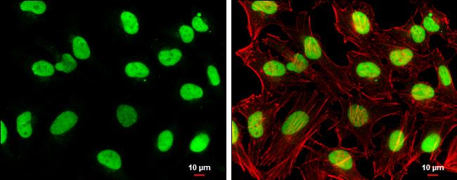 TOP2B Antibody