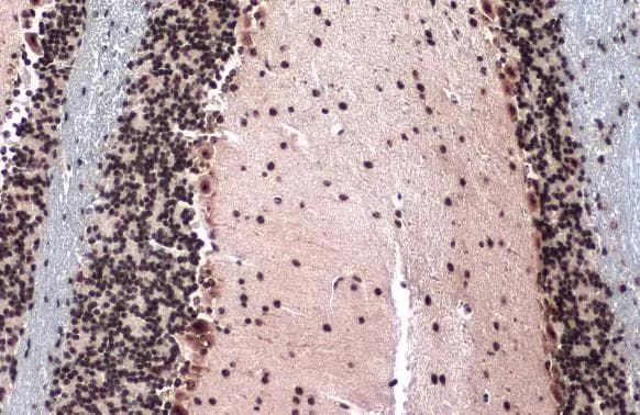 TOP2B Antibody