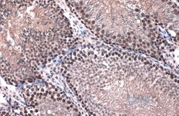 TOP2B Antibody