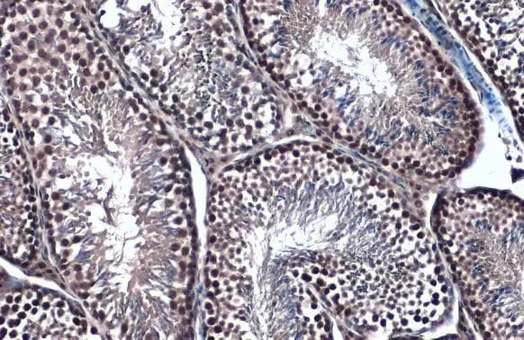 TOP2B Antibody