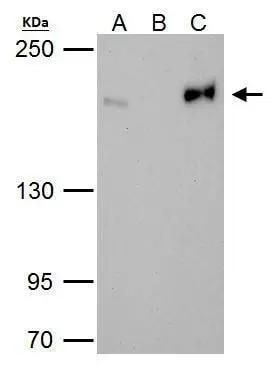 TOP2B Antibody