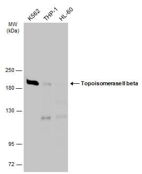 TOP2B Antibody