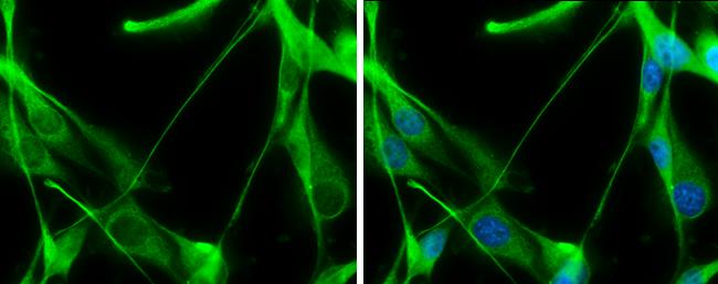 Transaldolase 1 Antibody