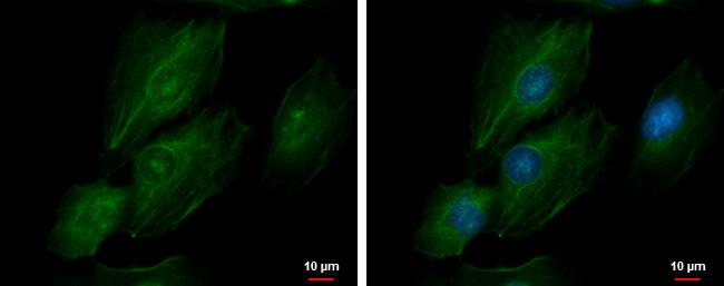 transgelin 2 Antibody