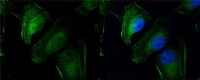 transgelin 2 Antibody