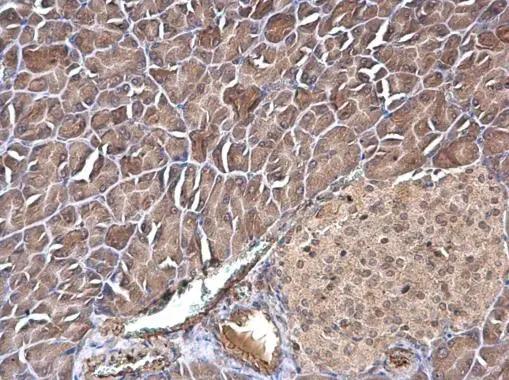 transgelin 2 Antibody