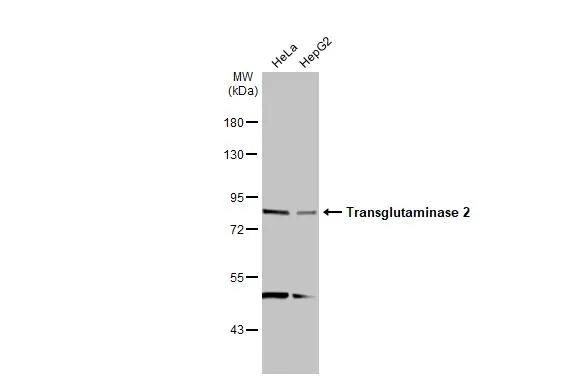 Transglutaminase 2/TGM2 Antibody