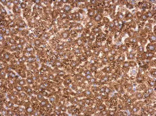 Transketolase Antibody