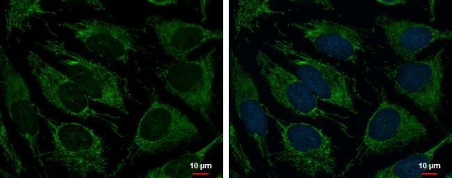 TRAP1 Antibody
