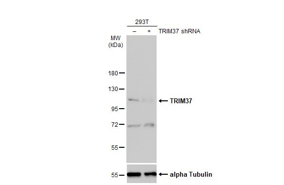 TRIM37 Antibody - BSA Free