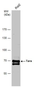 TRIOBP Antibody