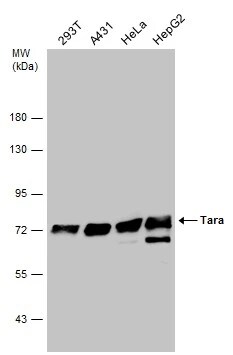TRIOBP Antibody