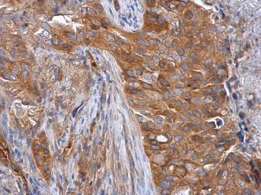 TRIOBP Antibody - BSA Free