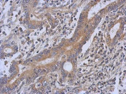 TRIT1 Antibody