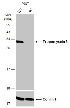 tropomyosin-3 Antibody - BSA Free
