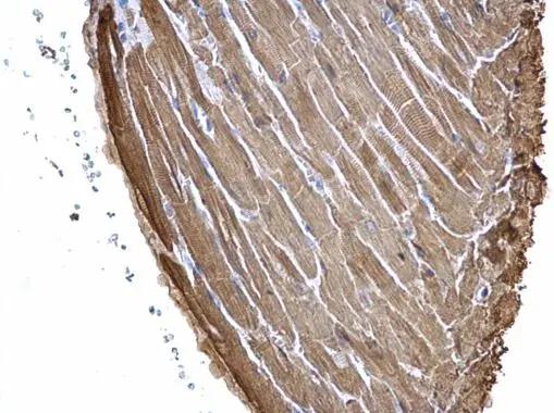 Troponin I Type 3 (cardiac) Antibody - Azide Free