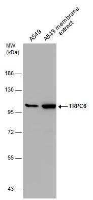 TRPC6 Antibody