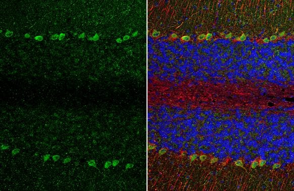 TRPC6 Antibody - BSA Free