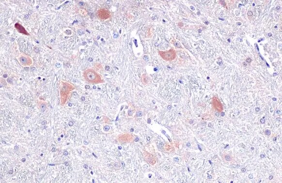 Tryptophanyl tRNA synthetase Antibody