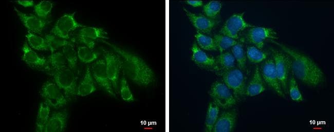 TSFM Antibody