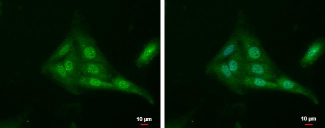 Tubby Antibody