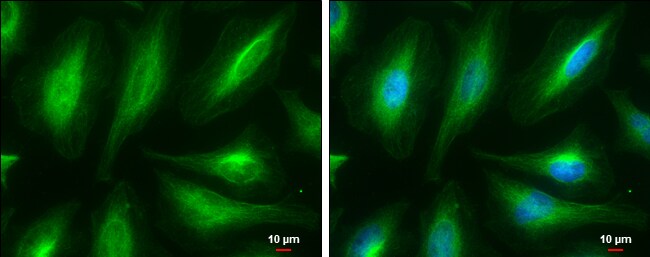 Tubulin alpha-1B Antibody