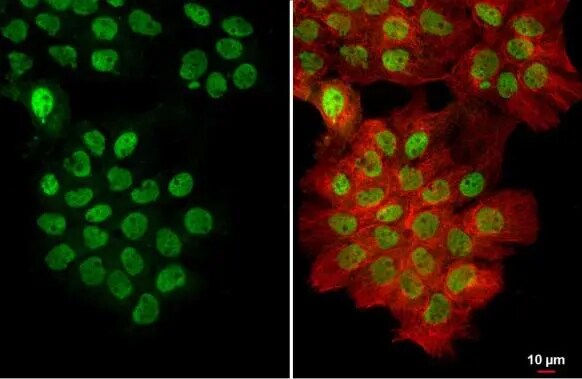 U2AF2 Antibody