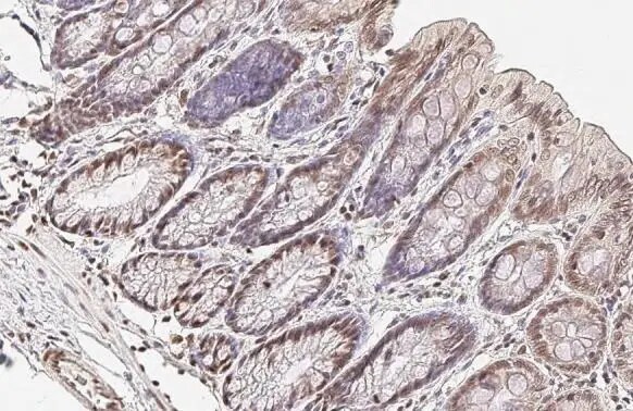 U2AF2 Antibody