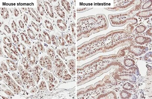 U2AF2 Antibody