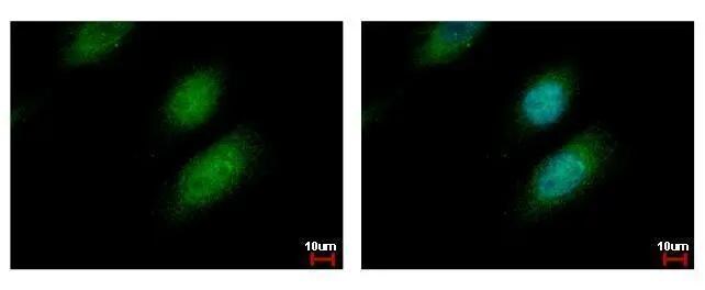 HR6A/UBE2A Antibody - BSA Free