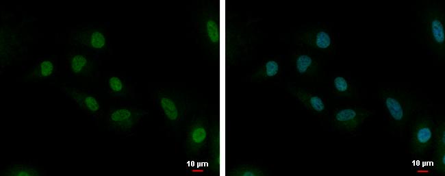 UbcH10/UBE2C Antibody - BSA Free
