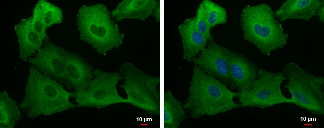 UBPY/USP8 Antibody
