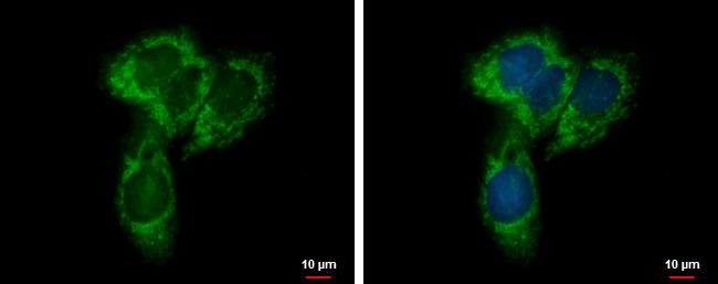 UQCRC1 Antibody - BSA Free