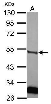 u-Plasminogen Activator/Urokinase Antibody - BSA Free