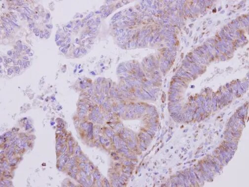 VARS Antibody