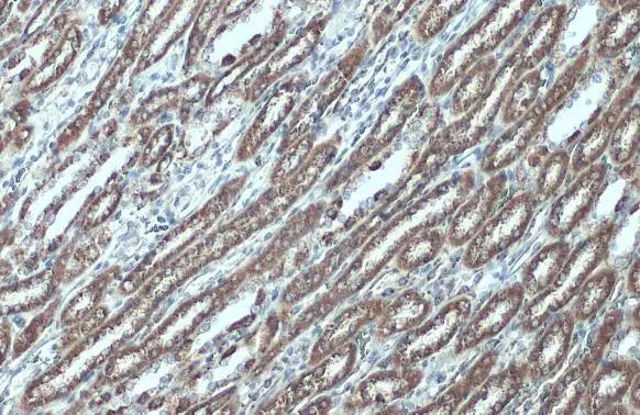 VDAC2 Antibody - BSA Free